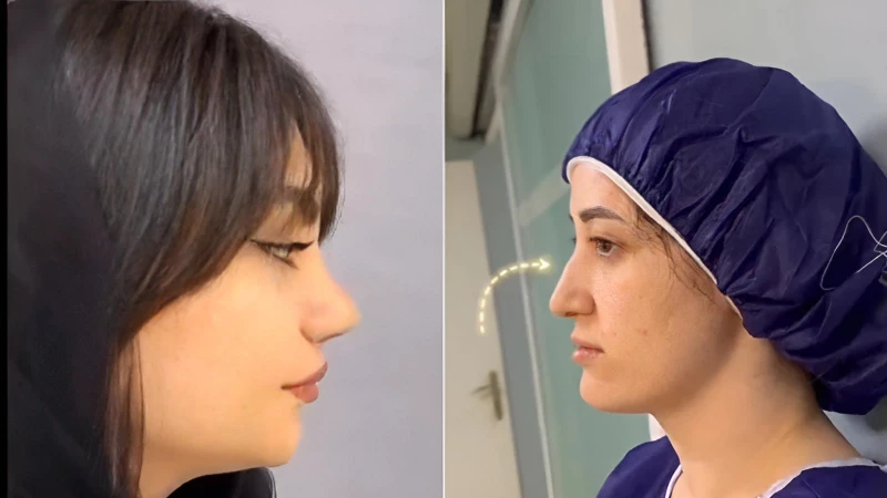 فرم فانتزی طبیعی با نوک خوش‌تراش — دکتر علی شکرریز