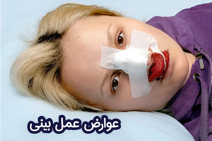 عوارض جراحی بینی