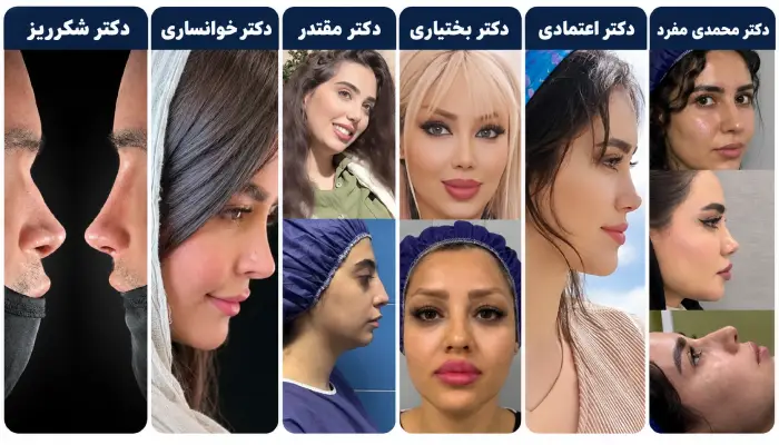 نمونه کارهای جراحی بینی
