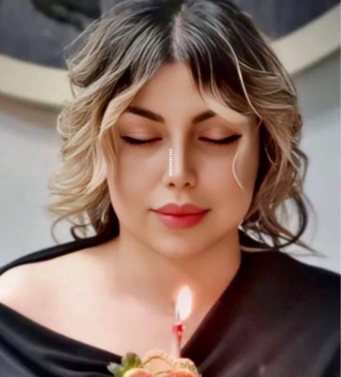 نمونه نتیجه جراحی بینی دکتر اکبر اعتمادی