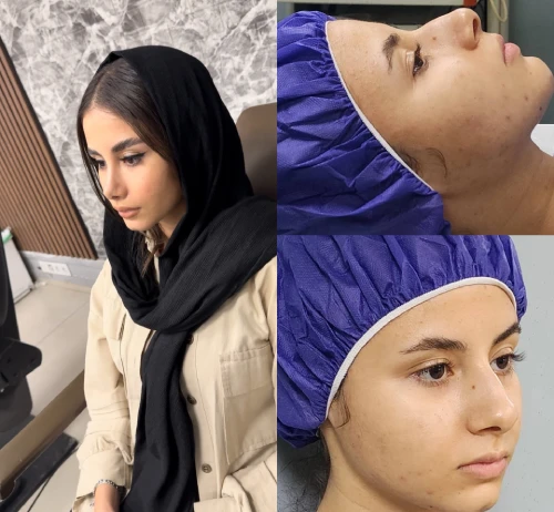 نمونه فرم بینی طراحی شده توسط دکتر آرزو خوانساری‌نیا