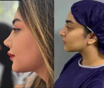 نمونه جراحی بینی دکتر امین بختیاری